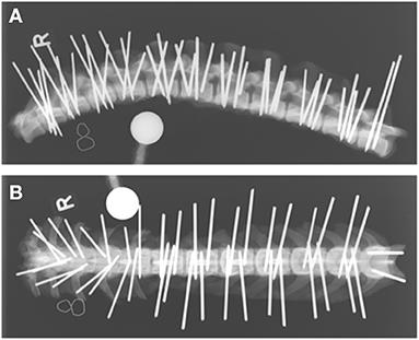 Accuracy of end-on fluoroscopy in predicting implant position in relation to the vertebral canal in dogs